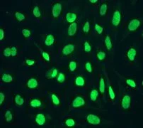 Immunocytochemistry/ Immunofluorescence - Anti-CHD3 antibody [EPNCIR110A] - BSA and Azide free (AB240942)