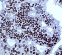 Immunohistochemistry (Formalin/PFA-fixed paraffin-embedded sections) - Anti-CHD3 antibody [EPNCIR110A] - BSA and Azide free (AB240942)