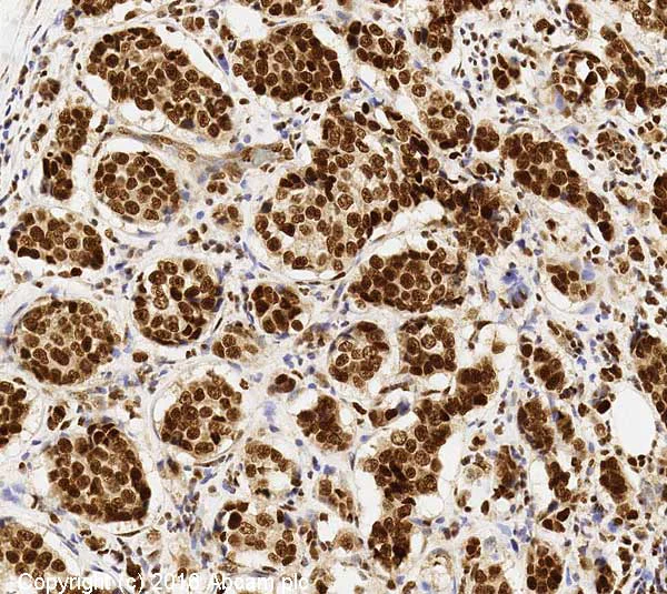 Immunohistochemistry (Formalin/PFA-fixed paraffin-embedded sections) - Anti-CHD4 antibody [3F2/4] (AB70469)