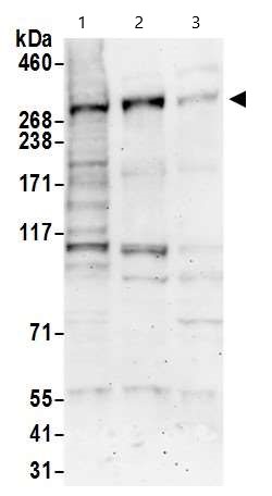 Western blot - Anti-CHD4 antibody (AB72418)