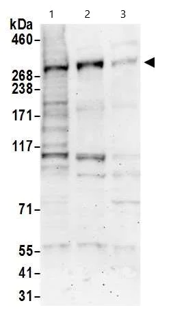 Western blot - Anti-CHD4 antibody (AB72418)