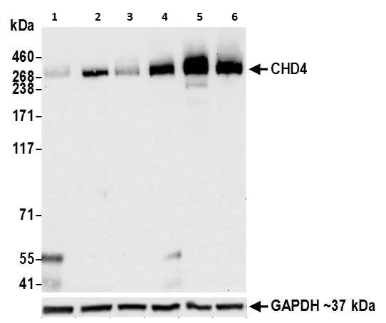 Western blot - Anti-CHD4 antibody [BLR066G] (AB264417)