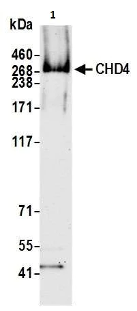 Western blot - Anti-CHD4 antibody [BLR066G] (AB264417)