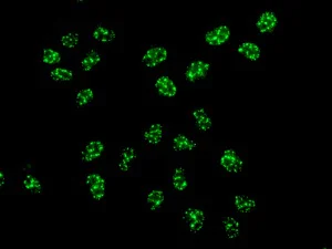 Immunocytochemistry/ Immunofluorescence - Anti-CHD4 antibody [EPR12229] - BSA and Azide free (AB250495)