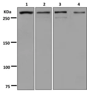Western blot - Anti-CHD4 antibody [EPR12229] - BSA and Azide free (AB250495)
