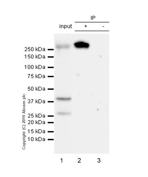 Immunoprecipitation - Anti-CHD4 antibody [EPR22953-38] - ChIP Grade (AB240640), expandable thumbnail