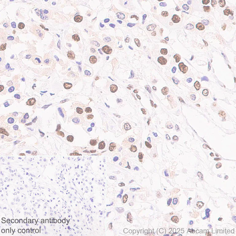Immunohistochemistry (Formalin/PFA-fixed paraffin-embedded sections) - Anti-CHD4 antibody [EPR29845-521] (AB324561)