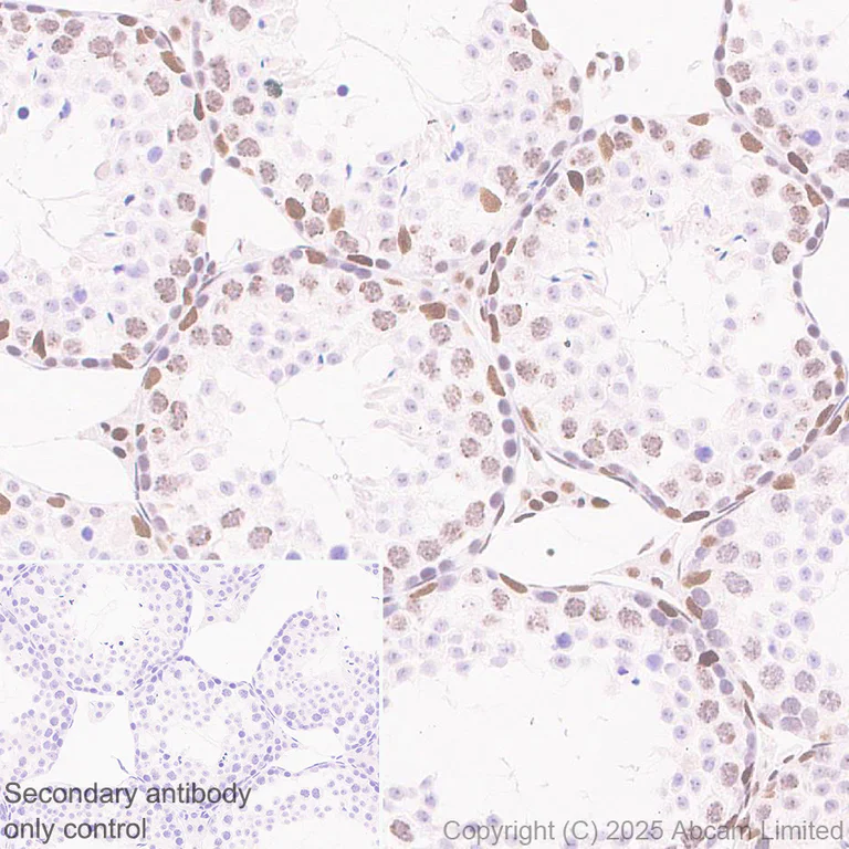 Immunohistochemistry (Formalin/PFA-fixed paraffin-embedded sections) - Anti-CHD4 antibody [EPR29845-521] (AB324561)