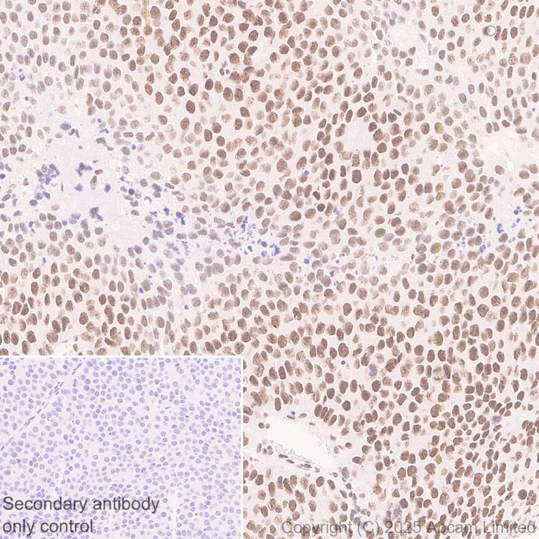 Immunohistochemistry (Formalin/PFA-fixed paraffin-embedded sections) - Anti-CHD4 antibody [EPR29845-521] (AB324561)