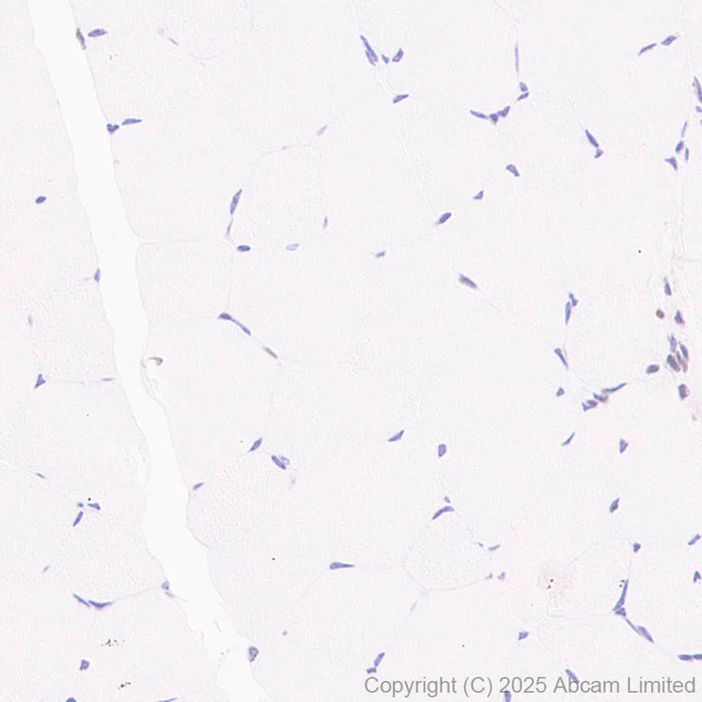 Immunohistochemistry (Formalin/PFA-fixed paraffin-embedded sections) - Anti-CHD4 antibody [EPR29845-521] (AB324561)