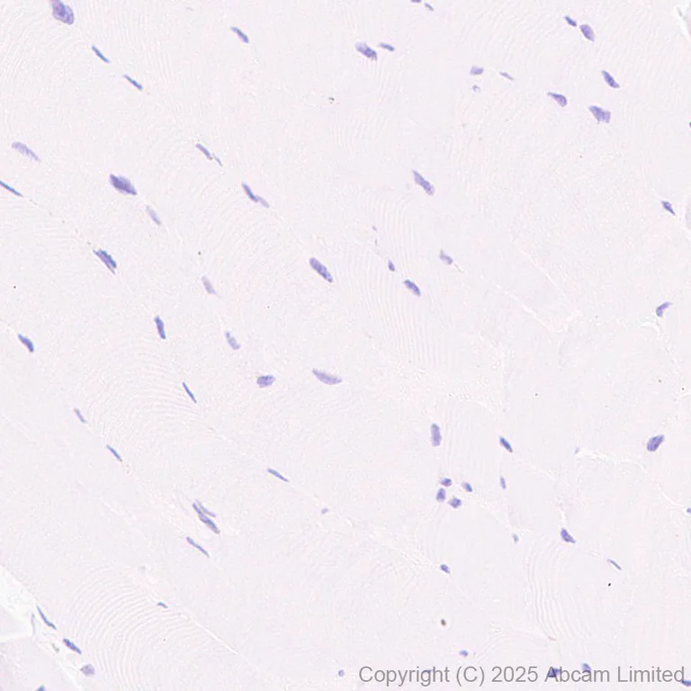 Immunohistochemistry (Formalin/PFA-fixed paraffin-embedded sections) - Anti-CHD4 antibody [EPR29845-521] (AB324561)