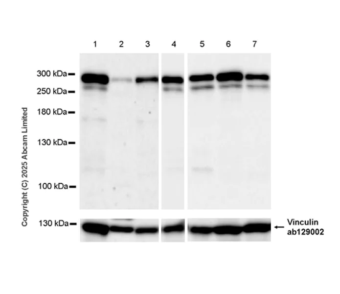 Western blot - Anti-CHD4 antibody [EPR29845-521] (AB324561)