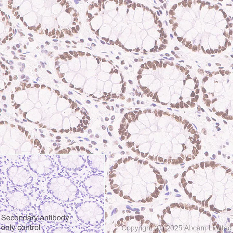 Immunohistochemistry (Formalin/PFA-fixed paraffin-embedded sections) - Anti-CHD4 antibody [EPR29845-521] - BSA and Azide free (AB324570)
