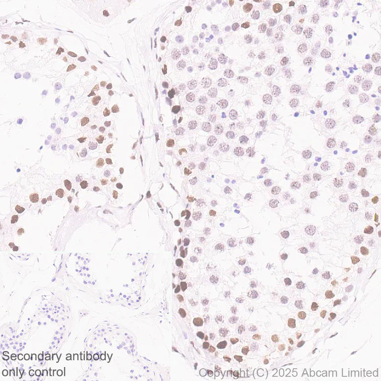 Immunohistochemistry (Formalin/PFA-fixed paraffin-embedded sections) - Anti-CHD4 antibody [EPR29845-521] - BSA and Azide free (AB324570)
