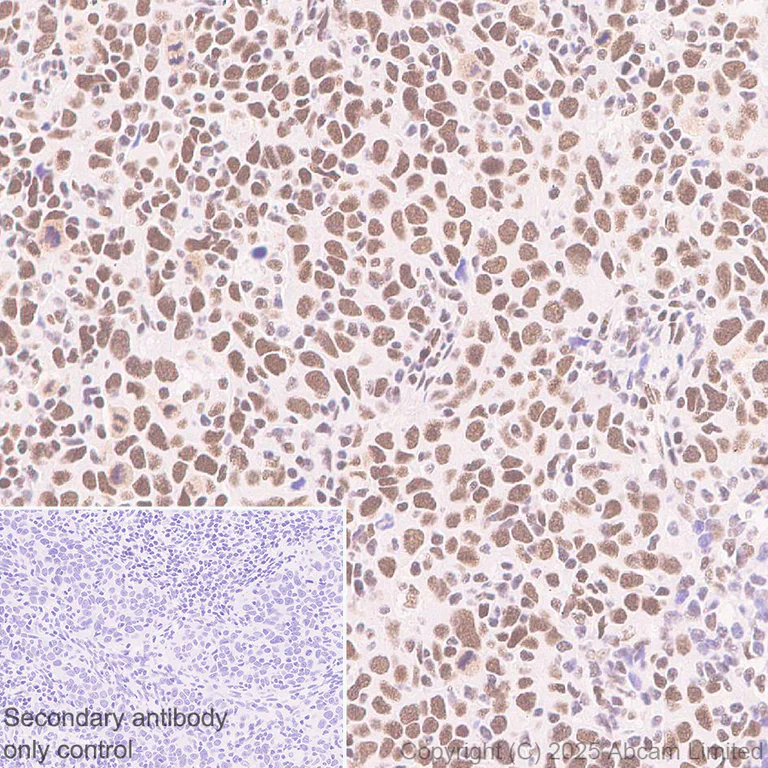 Immunohistochemistry (Formalin/PFA-fixed paraffin-embedded sections) - Anti-CHD4 antibody [EPR29845-521] - BSA and Azide free (AB324570)