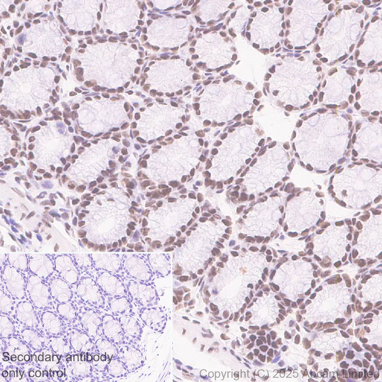 Immunohistochemistry (Formalin/PFA-fixed paraffin-embedded sections) - Anti-CHD4 antibody [EPR29845-521] - BSA and Azide free (AB324570)
