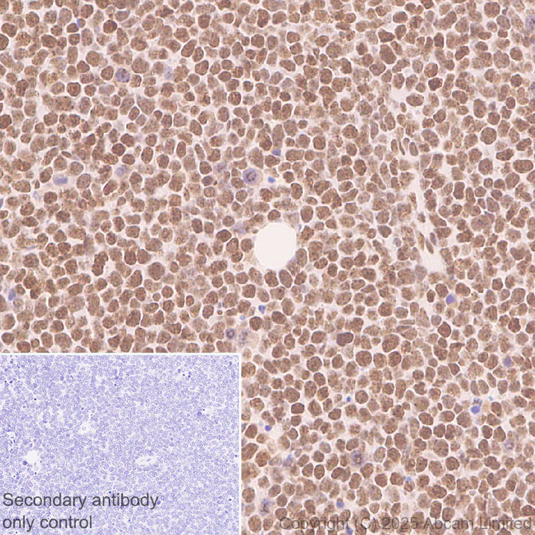 Immunohistochemistry (Formalin/PFA-fixed paraffin-embedded sections) - Anti-CHD4 antibody [EPR29845-521] - BSA and Azide free (AB324570)