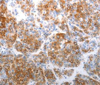 Immunohistochemistry (Formalin/PFA-fixed paraffin-embedded sections) - Anti-CHD5 antibody - C-terminal (AB202132)