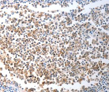 Immunohistochemistry (Formalin/PFA-fixed paraffin-embedded sections) - Anti-CHD5 antibody - C-terminal (AB202132)