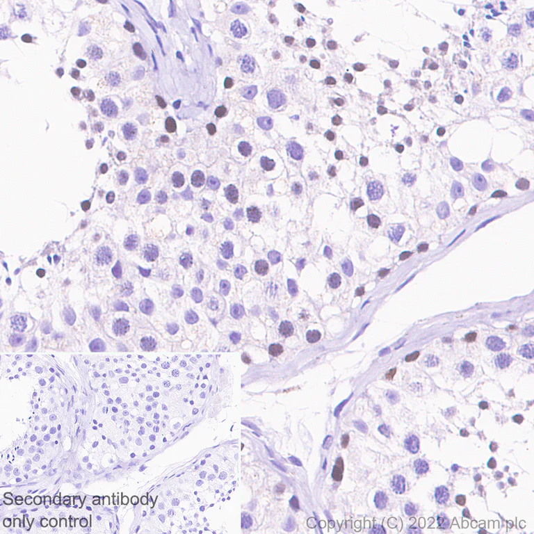Immunohistochemistry (Formalin/PFA-fixed paraffin-embedded sections) - Anti-CHD5 antibody [EPR23858-3-8] (AB300437)