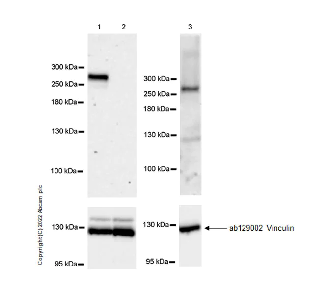 Western blot - Anti-CHD5 antibody [EPR23858-3-8] (AB300437)