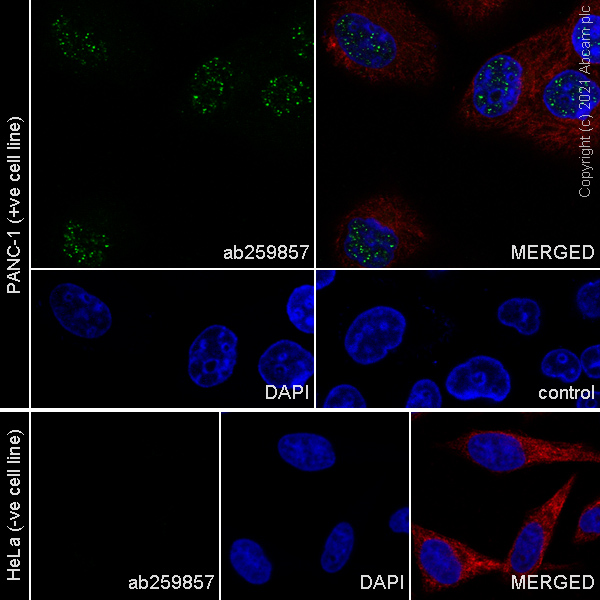 Immunocytochemistry/ Immunofluorescence - Anti-CHD5 antibody [EPR23858-3] (AB259857), expandable thumbnail