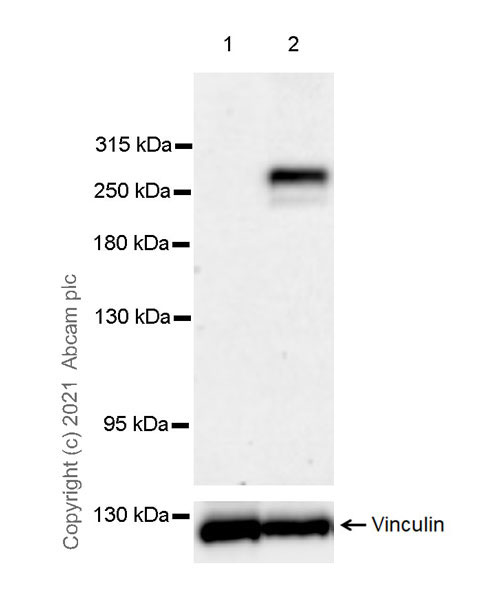 Western blot - Anti-CHD5 antibody [EPR23858-3] (AB259857), expandable thumbnail