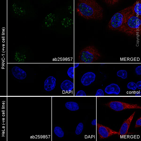 Immunocytochemistry/ Immunofluorescence - Anti-CHD5 antibody [EPR23858-3] - BSA and Azide free (AB282591)