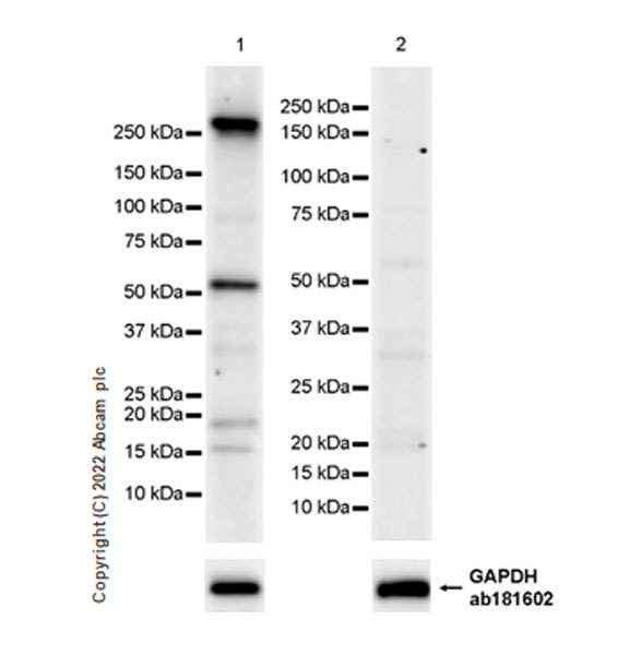 Western blot - Anti-CHD5 antibody [EPR27395-47] (AB307831), expandable thumbnail