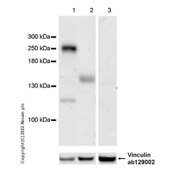 Western blot - Anti-CHD5 antibody [EPR27395-47] (AB307831)