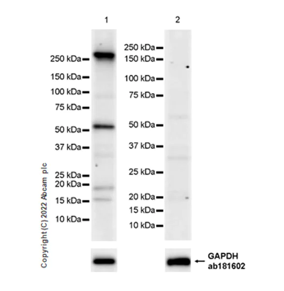 Western blot - Anti-CHD5 antibody [EPR27395-47] - BSA and Azide free (AB307832)