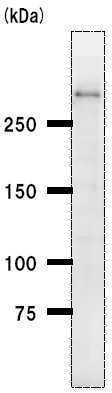 Western blot - Anti-CHD6 antibody [2174C2a] (AB51330)