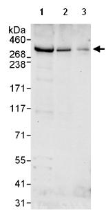 Western blot - Anti-CHD6 antibody (AB114095), expandable thumbnail
