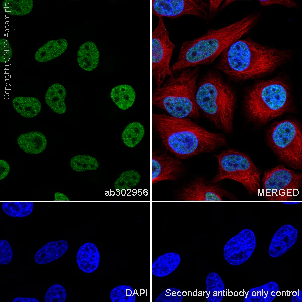 Immunocytochemistry - Anti-CHD6 antibody [EPR26714-1] (AB302956)