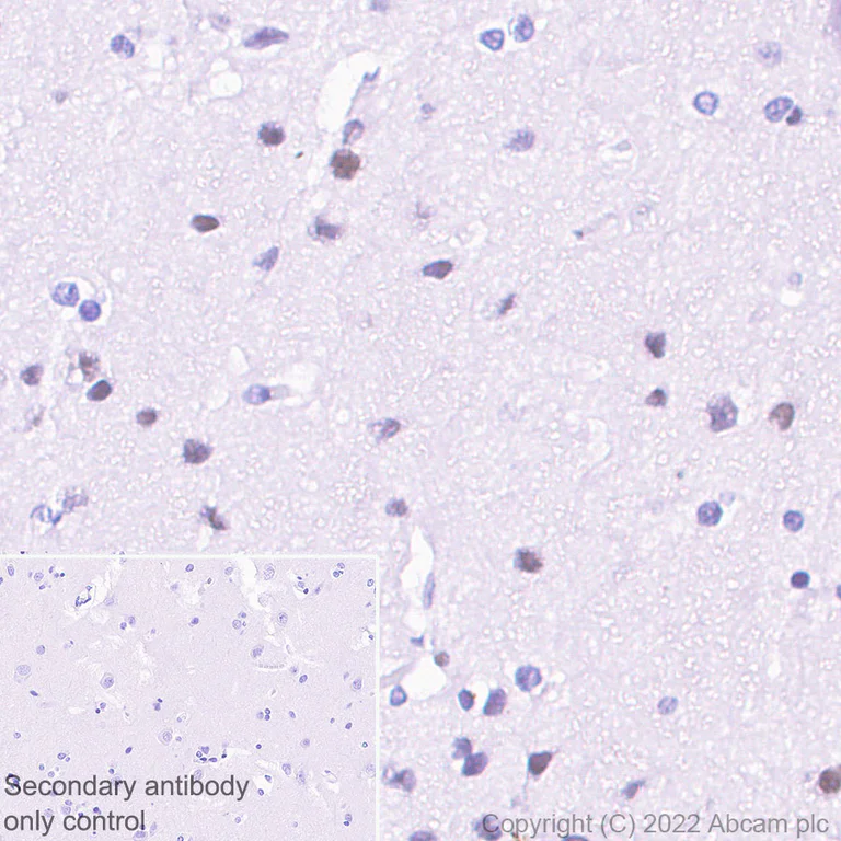 Immunohistochemistry - Anti-CHD6 antibody [EPR26714-1] (AB302956)