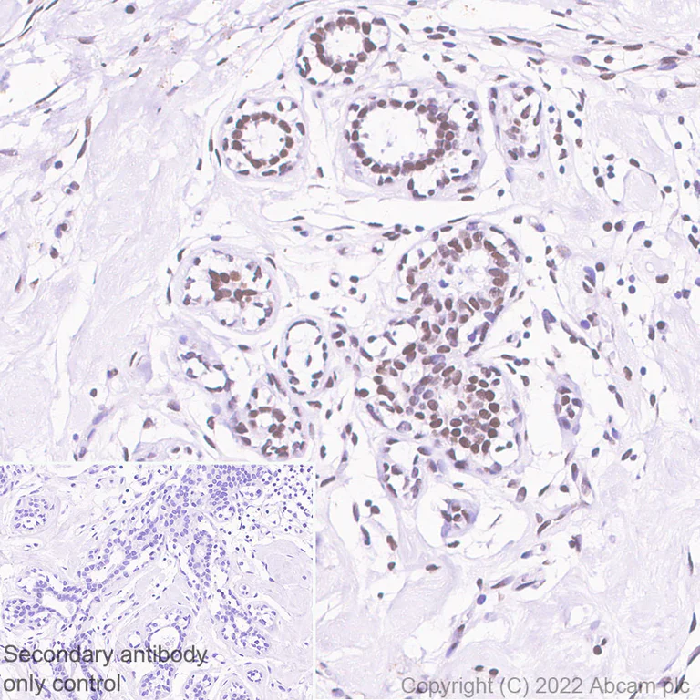 Immunohistochemistry - Anti-CHD6 antibody [EPR26714-1] (AB302956)