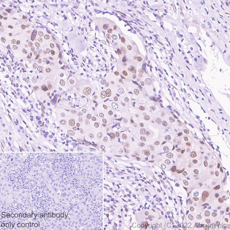 Immunohistochemistry - Anti-CHD6 antibody [EPR26714-1] (AB302956)