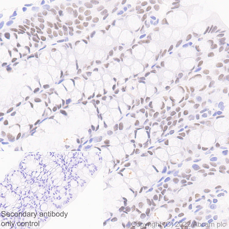 Immunohistochemistry (Formalin/PFA-fixed paraffin-embedded sections) - Anti-CHD7 antibody [EPR25355-7] (AB307499)