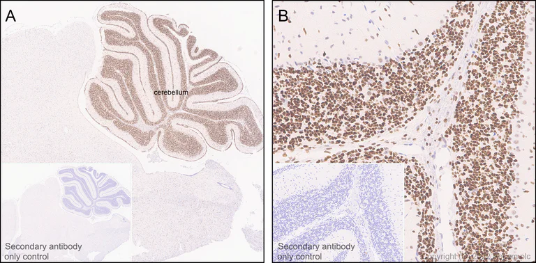 Immunohistochemistry (Formalin/PFA-fixed paraffin-embedded sections) - Anti-CHD7 antibody [EPR25355-7] (AB307499)