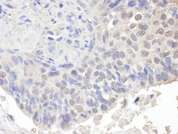 Immunohistochemistry (Formalin/PFA-fixed paraffin-embedded sections) - Anti-CHD8 antibody (AB114126), expandable thumbnail