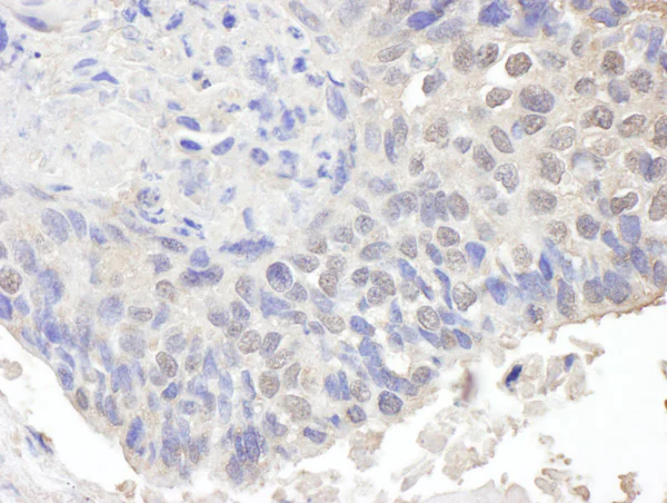 Immunohistochemistry (Formalin/PFA-fixed paraffin-embedded sections) - Anti-CHD8 antibody (AB114126)