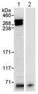 Immunoprecipitation - Anti-CHD8 antibody (AB114126), expandable thumbnail