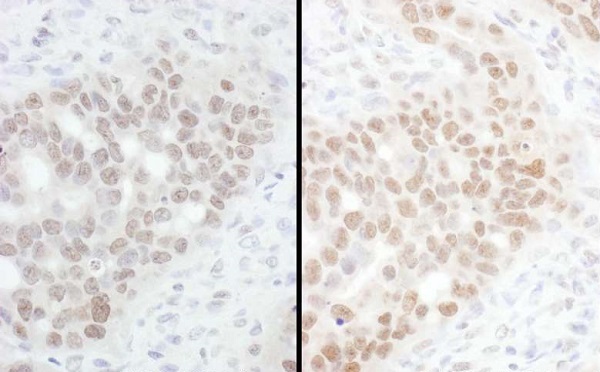 Immunohistochemistry (Formalin/PFA-fixed paraffin-embedded sections) - Anti-CHD8 antibody (AB224830)