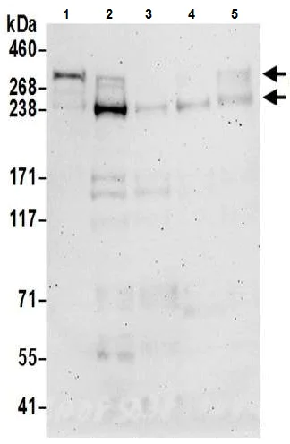 Western blot - Anti-CHD8 antibody (AB224830)
