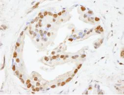 Immunohistochemistry (Formalin/PFA-fixed paraffin-embedded sections) - Anti-CHD8 antibody (AB84527)