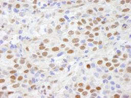 Immunohistochemistry (Formalin/PFA-fixed paraffin-embedded sections) - Anti-CHD8 antibody (AB84527)
