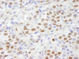 Immunohistochemistry (Formalin/PFA-fixed paraffin-embedded sections) - Anti-CHD8 antibody (AB84527)
