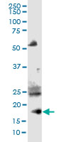 Western blot - Anti-Chemerin antibody (AB103153)