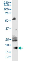 Western blot - Anti-Chemerin antibody (AB103153)