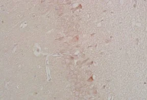 Immunohistochemistry (Formalin/PFA-fixed paraffin-embedded sections) - Anti-Chemerin antibody (AB203040)